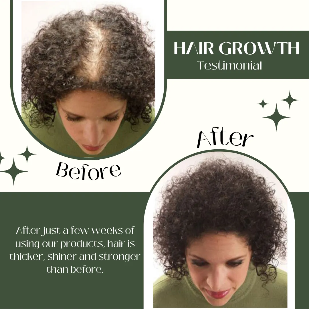 AS- Ginger Hair Care Combo Pack: Luscious Locks - Herbishh